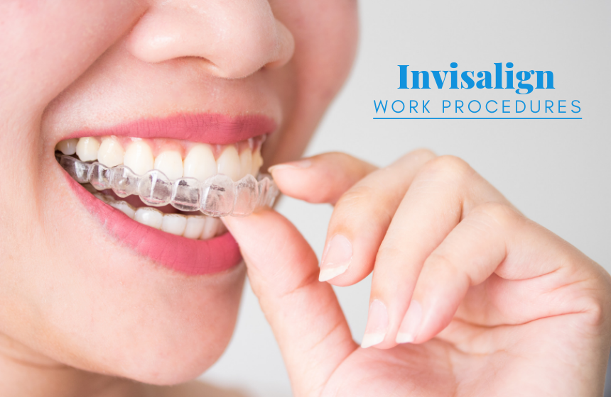 Simple Can You Workout With Invisalign for Weight Loss