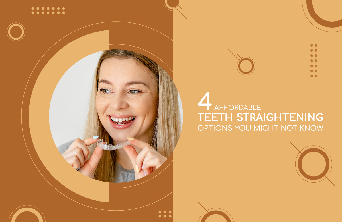 4 Affordable Teeth Straightening Options You Might Not Know