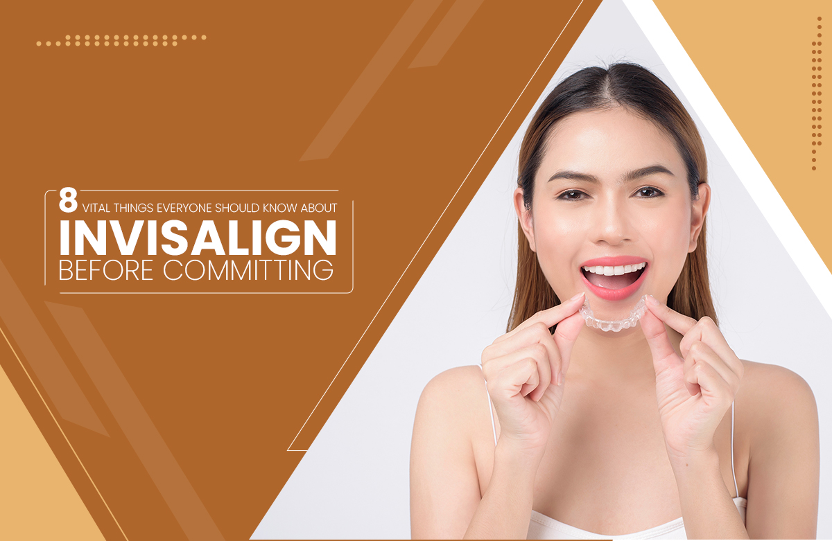 8 Vital Things Everyone Should Know About Invisalign Before Committing