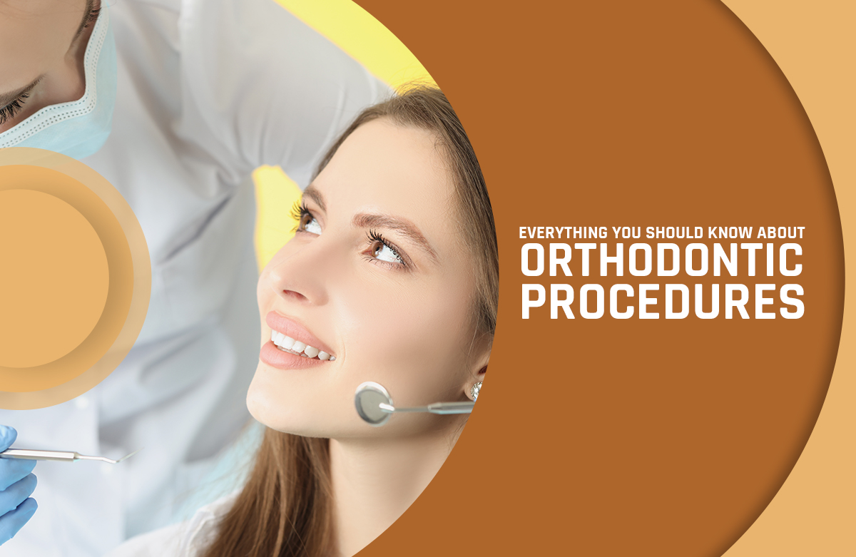 Everything You Should Know About Orthodontic Procedures