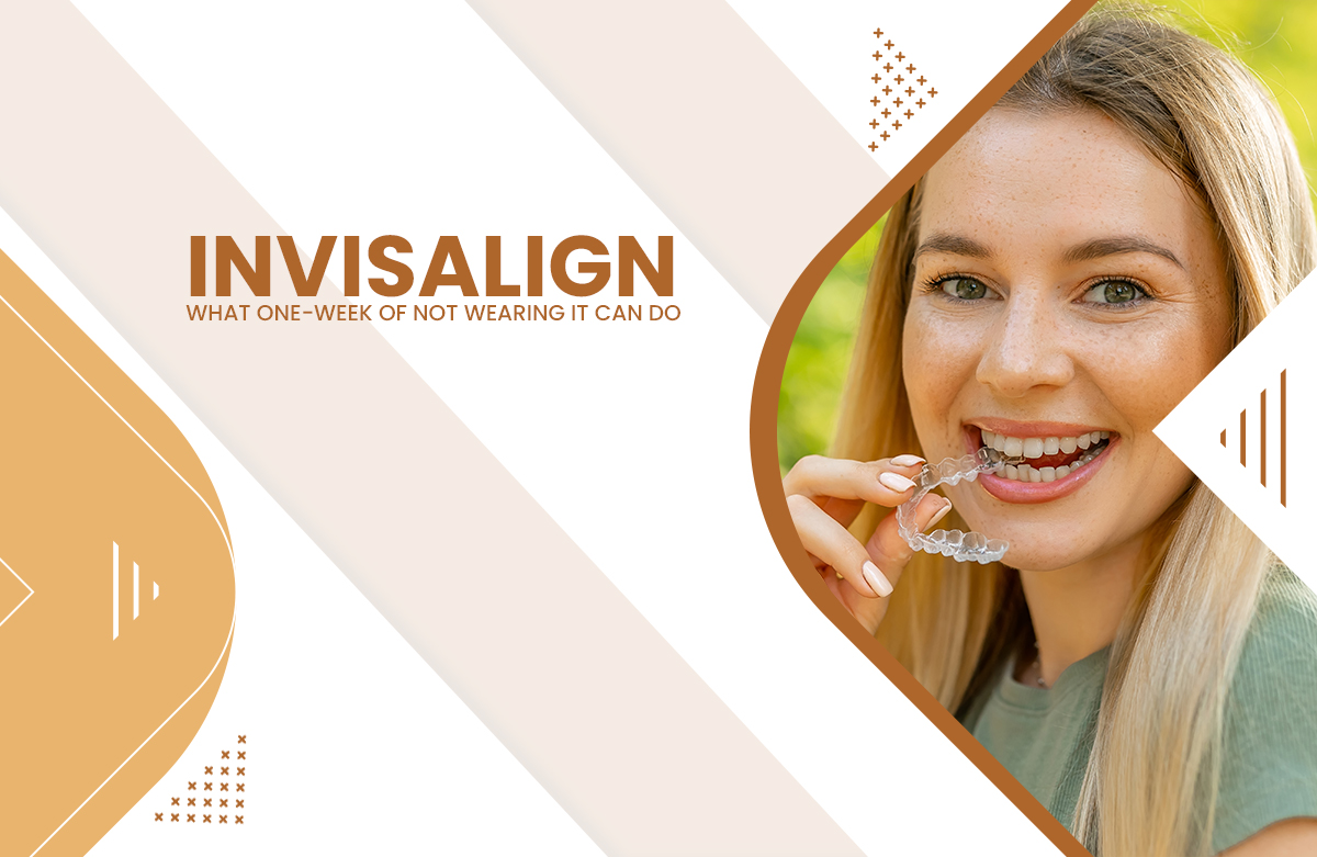 Invisalign: What One-week of Not Wearing It Can Do?