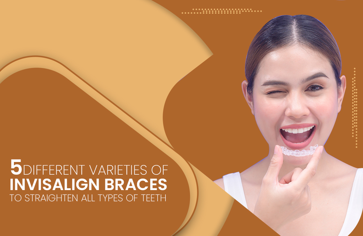 5 Different Varieties of Invisalign Braces to Straighten All Types of Teeth