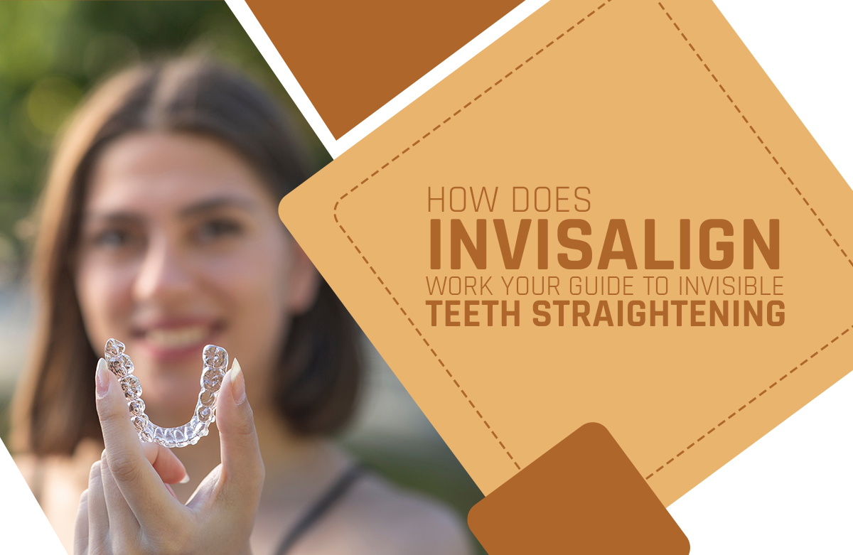 How Does Invisalign Work? Your Guide To Invisible Teeth Straightening