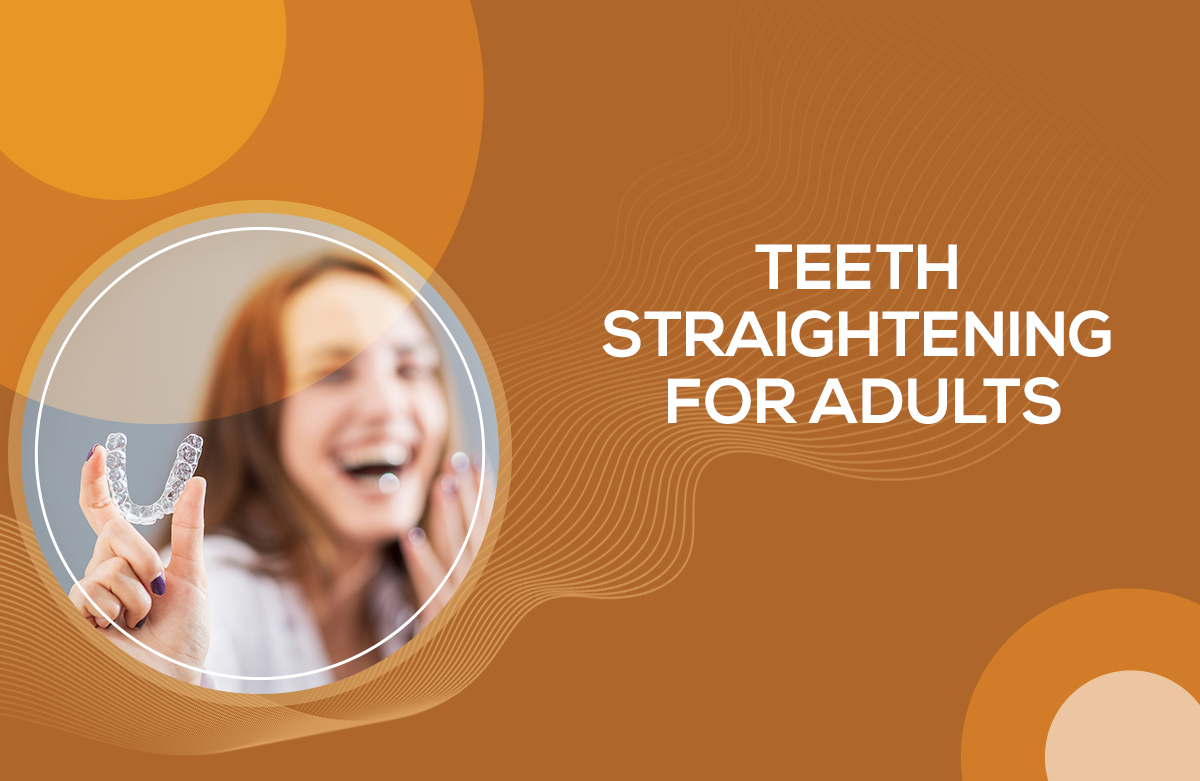 Teeth Straightening for Adults