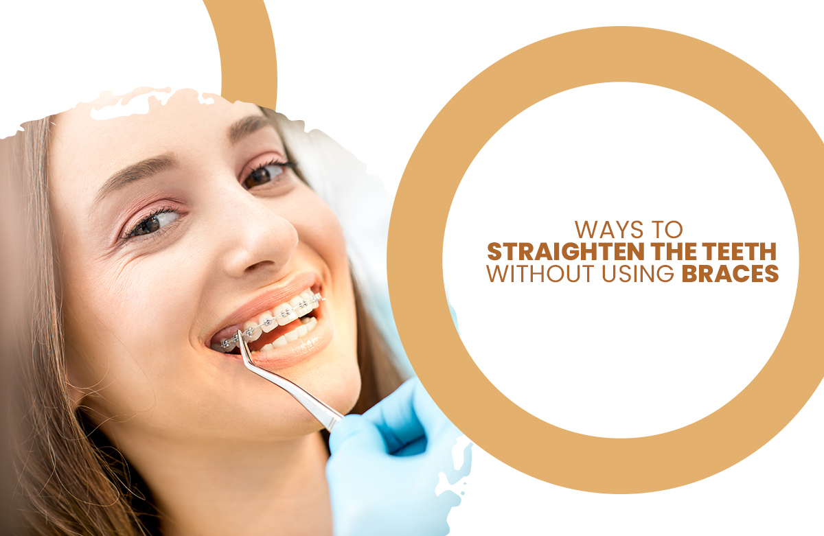 Ways to Straighten the Teeth without Using Braces