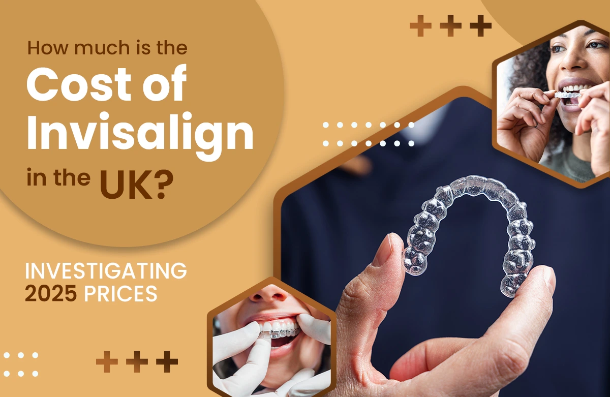 How much does Invisalign cost in the UK? Investigating 2025 prices
